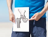 Why a hip replacement?