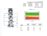 Densitometría del raquis lumbar Aparato Lunar
