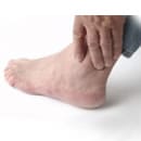 Quand l'arthrose touche le pied et la cheville