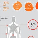 Aujourd’hui 1 français sur 3 souffre d’arthrose