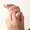 Arthrose des mains : symptômes et traitements