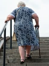 osteoarthritis-obesity