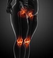 osteoarthritis-genetic