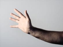 longitud de los dedos e predisposición a la osteoartritis de rodilla