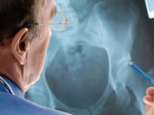 How Disabling Is Osteoarthritis Disability Benefits Help