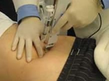 alternative medicine mesotherapy