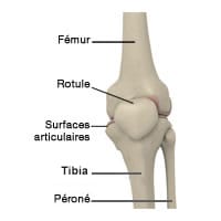 Prothèse du genou : opération pour l'arthrose du genou - Arthrolink