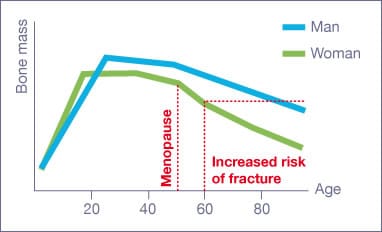 Changes in bone mass according to age