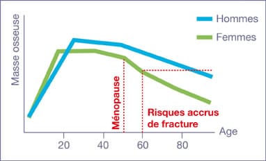 évolution de l'arthrose