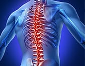 Ankylosing spondylitis