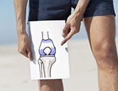 Pourquoi une prothèse du genou ?