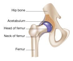 hip cross-cut