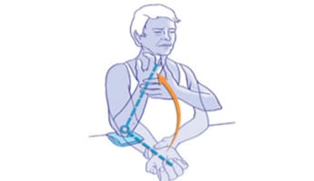 exercices articulaires arthrose du coude