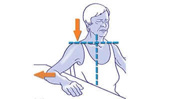 une prothèse de la hanche à cause de l'arthrose