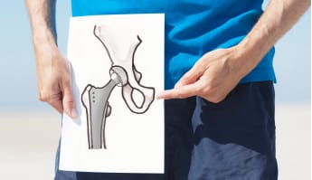 drugs for hip osteoarthritis