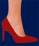 high-heeled shoe osteoarthritis
