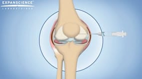 Les Infiltrations De Corticoides Ou De Viscosupplements Pour Les Articulations Arthrosiques Arthrolink