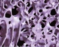 Fig 1 : Normal bone tissue