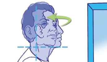 the frequency of cervical osteoarthritis